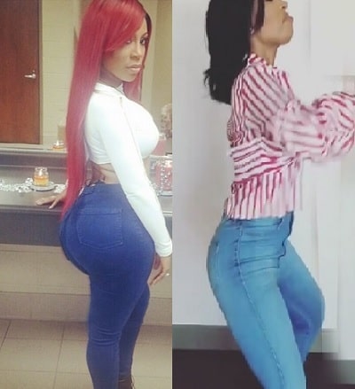 A picture of K. Michelle  before (left) and after (right) removing butt implants.